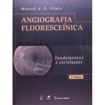 ANGIOGRAFIA FLUORESCEÍNICA - FUNDAMENTOS E CORRELAÇÕES