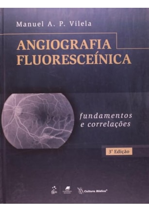 ANGIOGRAFIA FLUORESCEÍNICA - FUNDAMENTOS E CORRELAÇÕES