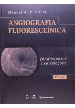 ANGIOGRAFIA FLUORESCEÍNICA - FUNDAMENTOS E CORRELAÇÕES