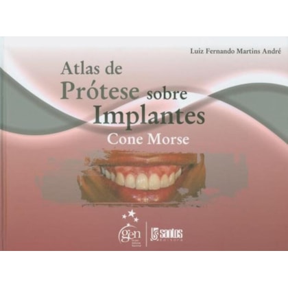 ATLAS DE PRÓTESE SOBRE IMPLANTES CONE MORSE