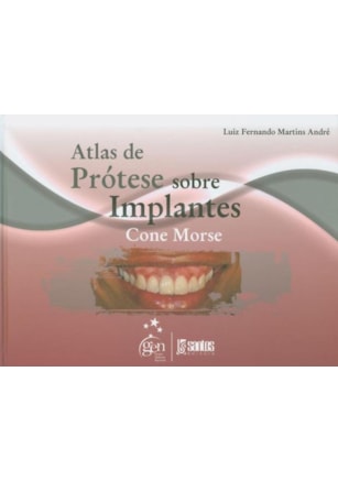 ATLAS DE PRÓTESE SOBRE IMPLANTES CONE MORSE
