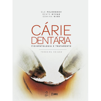 CÁRIES DENTÁRIAS