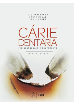 CÁRIES DENTÁRIAS