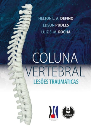 COLUNA VERTEBRAL