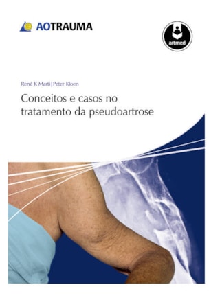 CONCEITOS E CASOS NO TRATAMENTO DA PSEUDOARTROSE