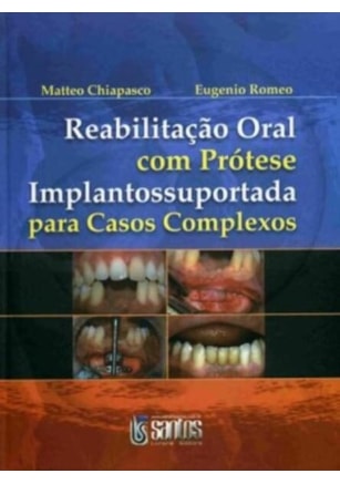 REABILITAÇÃO ORAL COM PRÓTESE IMPLANTOSSUPORTADA
