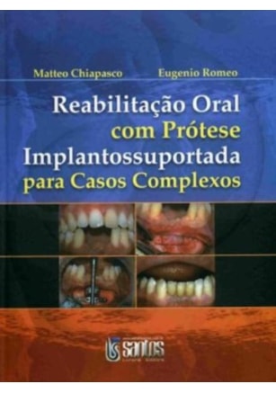 REABILITAÇÃO ORAL COM PRÓTESE IMPLANTOSSUPORTADA