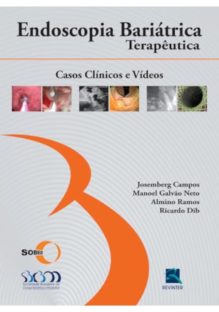 SOBED ENDOSCOPIA BARIÁTRICA TERAPÊUTICA